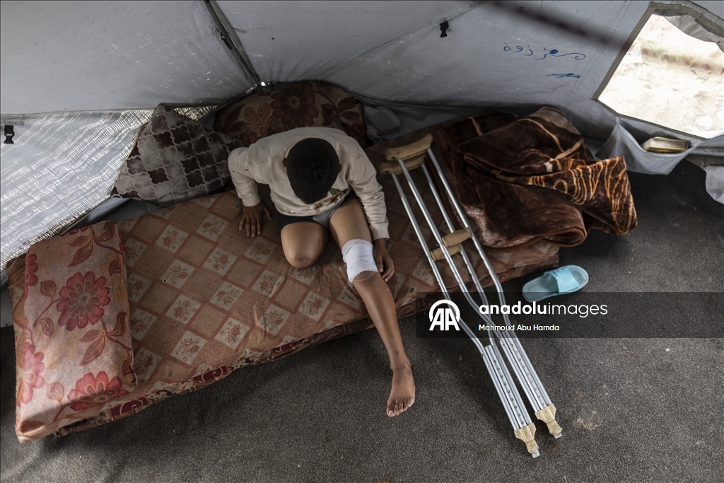 Лишившийся ноги маленький палестинец борется с вызовами с помощью семьи