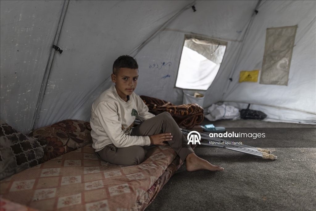 İsrail saldırısında bir bacağını kaybeden Filistinli çocuk ailesinin yardımıyla yaşama tutunuyor