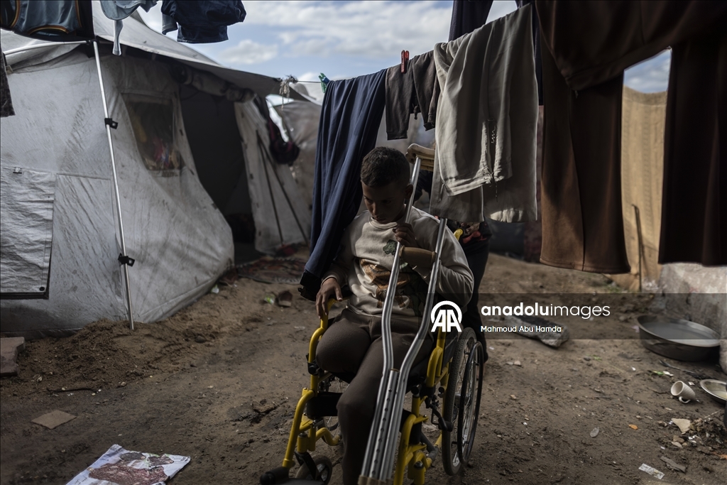 Лишившийся ноги маленький палестинец борется с вызовами с помощью семьи