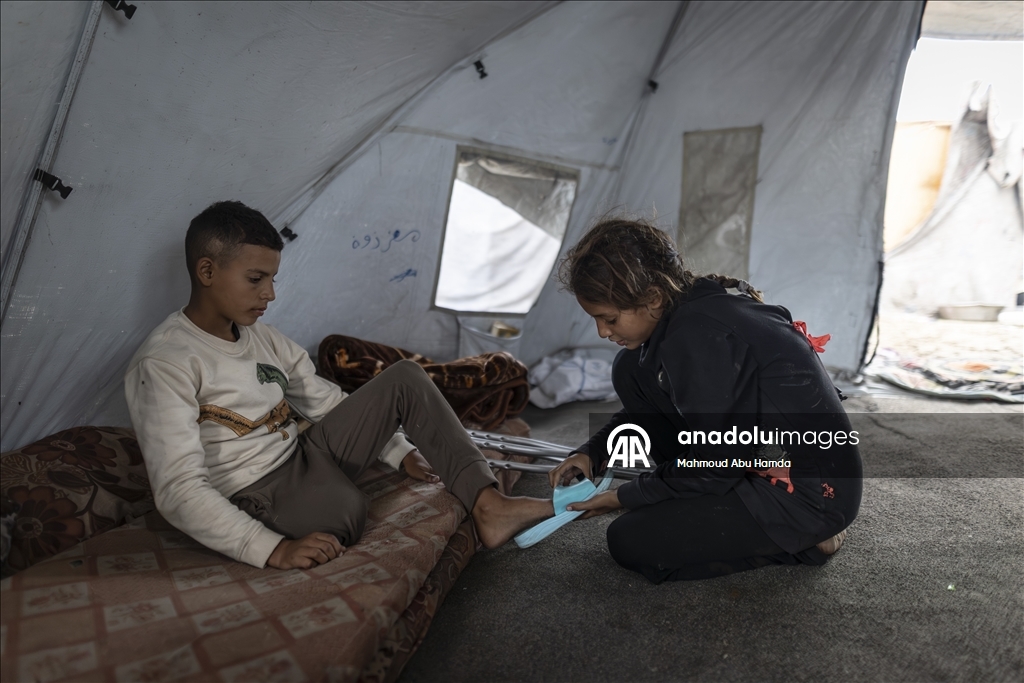 Лишившийся ноги маленький палестинец борется с вызовами с помощью семьи