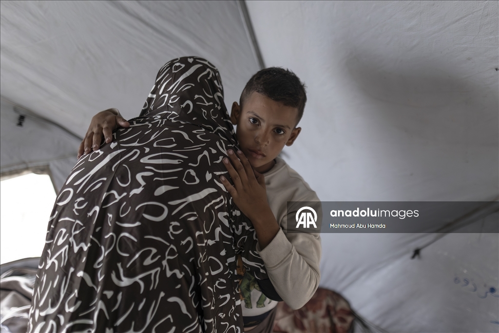 Лишившийся ноги маленький палестинец борется с вызовами с помощью семьи