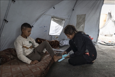 Лишившийся ноги маленький палестинец борется с вызовами с помощью семьи