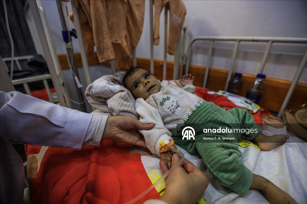 Gazze’de çocuklar ve hamile kadınlar yetersiz beslenme nedeniyle zor durumda