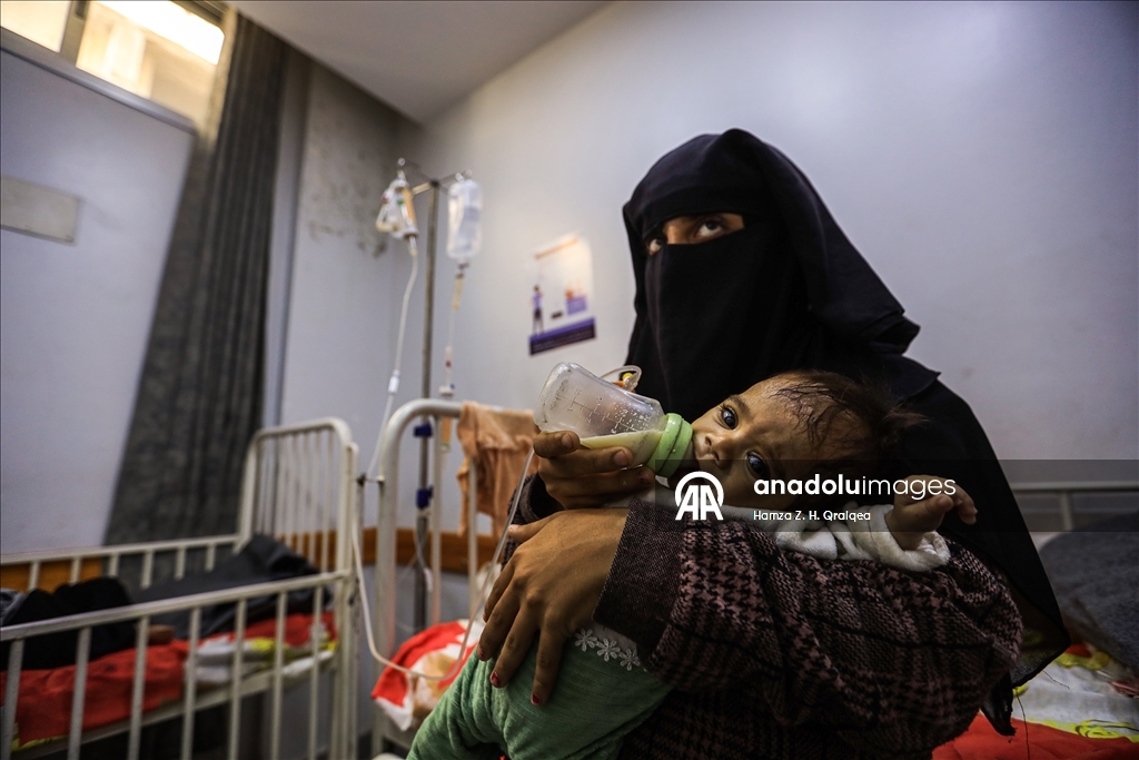 Gazze’de çocuklar ve hamile kadınlar yetersiz beslenme nedeniyle zor durumda