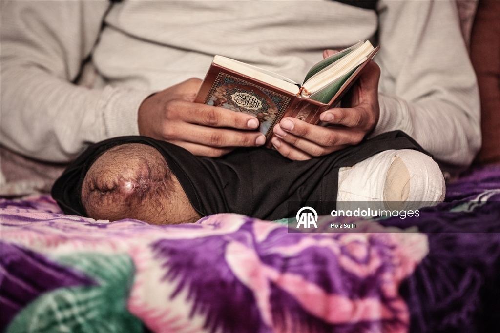 İsrail saldırısında iki bacağını kaybeden Gazzeli çocuk, eğitim hayatına dönmenin hayalini kuruyor