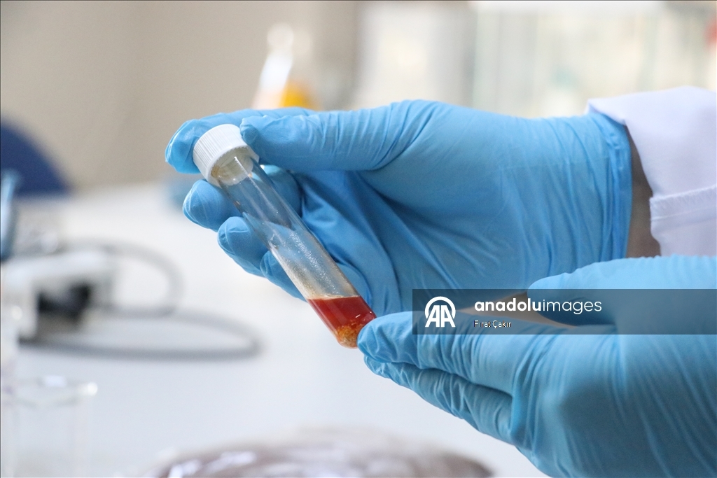 باحثون أتراك ينتجون زيتا أحادي الخلية من بقايا العنب