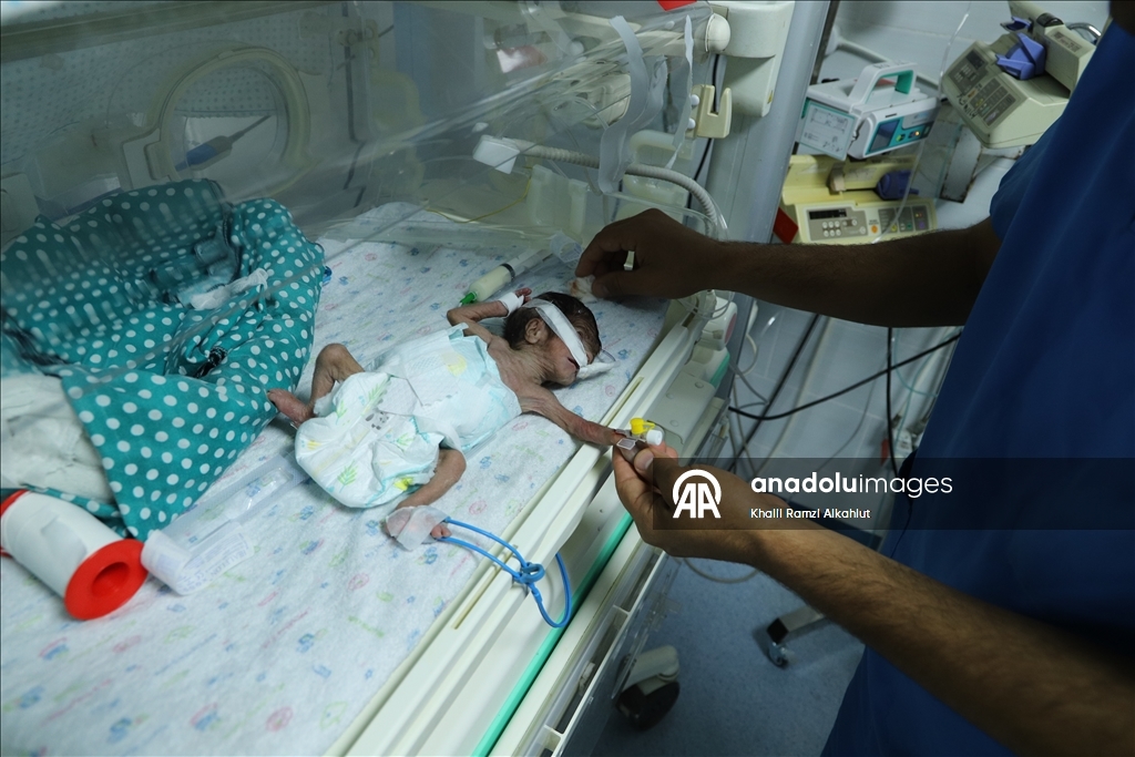 Gazze'de prematüre bebekler hayatta kalma mücadelesi veriyor