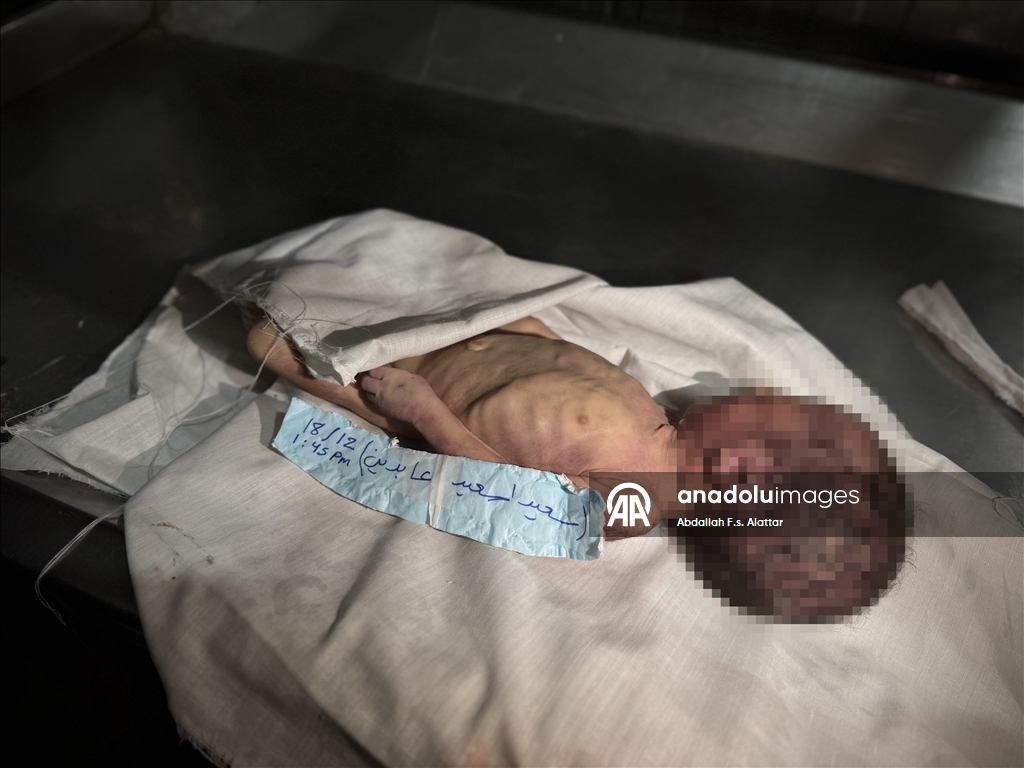 В Газе из-за сильных холодов умер младенец