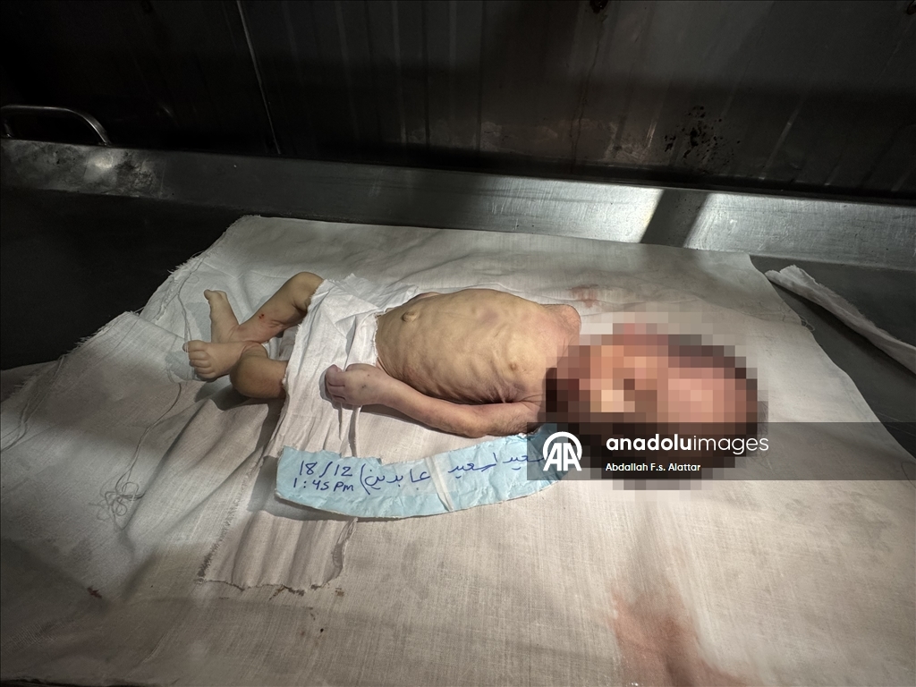 В Газе из-за сильных холодов умер младенец