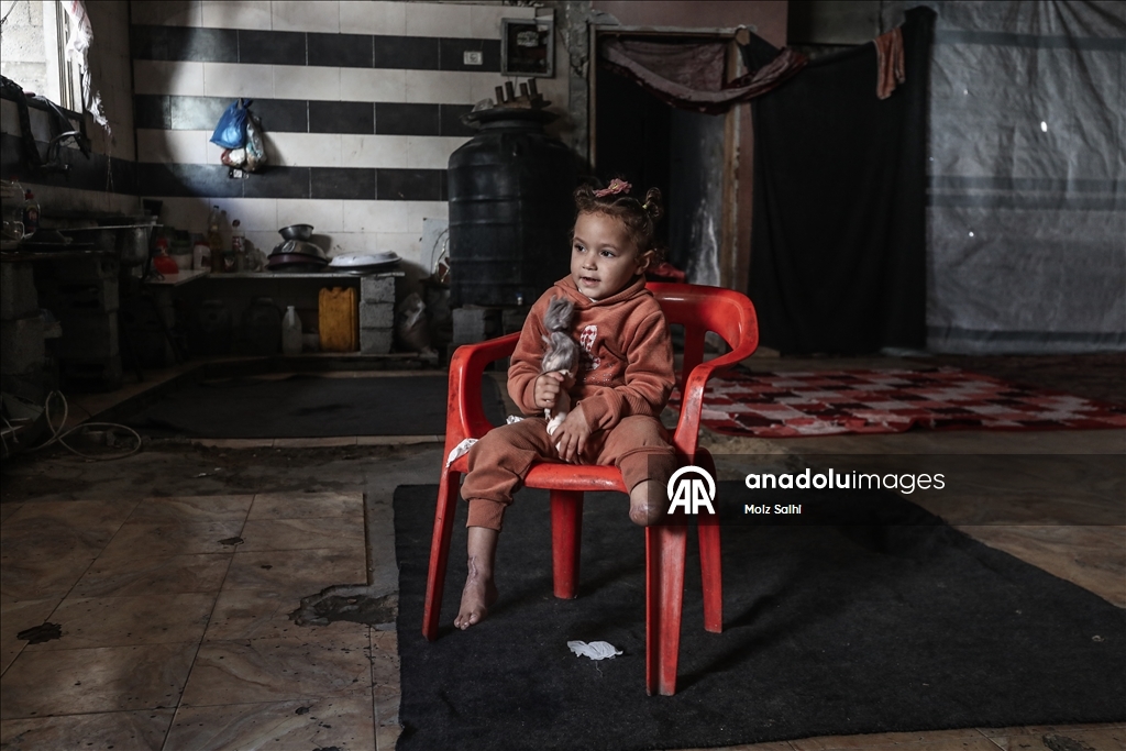 Надежда на протез для 4-летней Раван из Газы