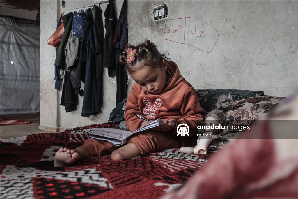 Надежда на протез для 4-летней Раван из Газы