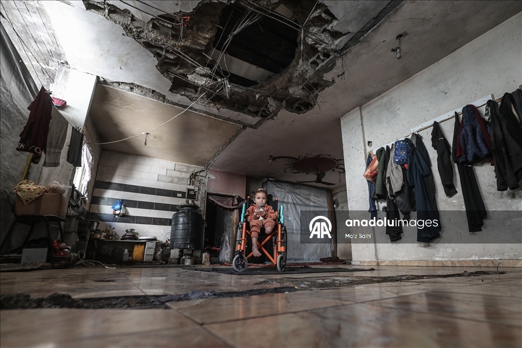 Надежда на протез для 4-летней Раван из Газы