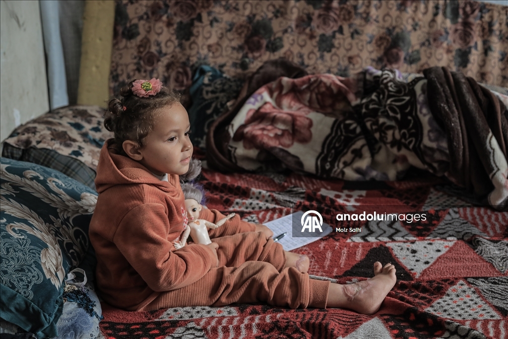 Надежда на протез для 4-летней Раван из Газы