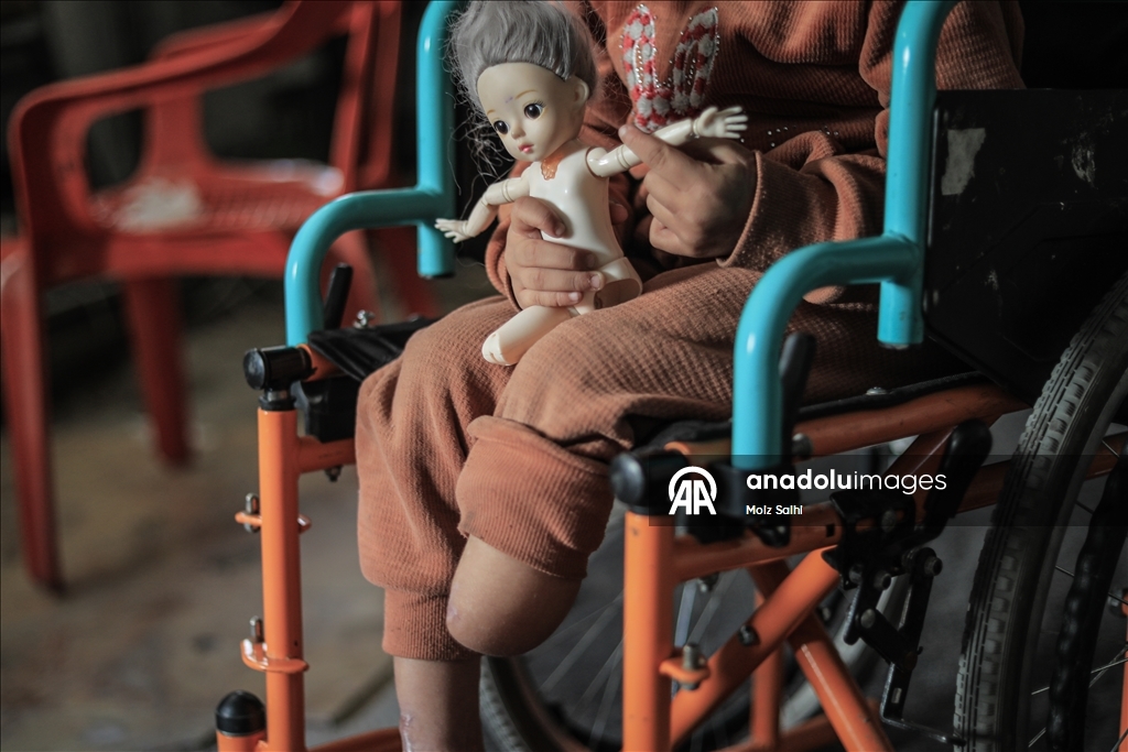 Надежда на протез для 4-летней Раван из Газы