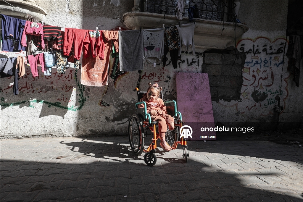 Надежда на протез для 4-летней Раван из Газы