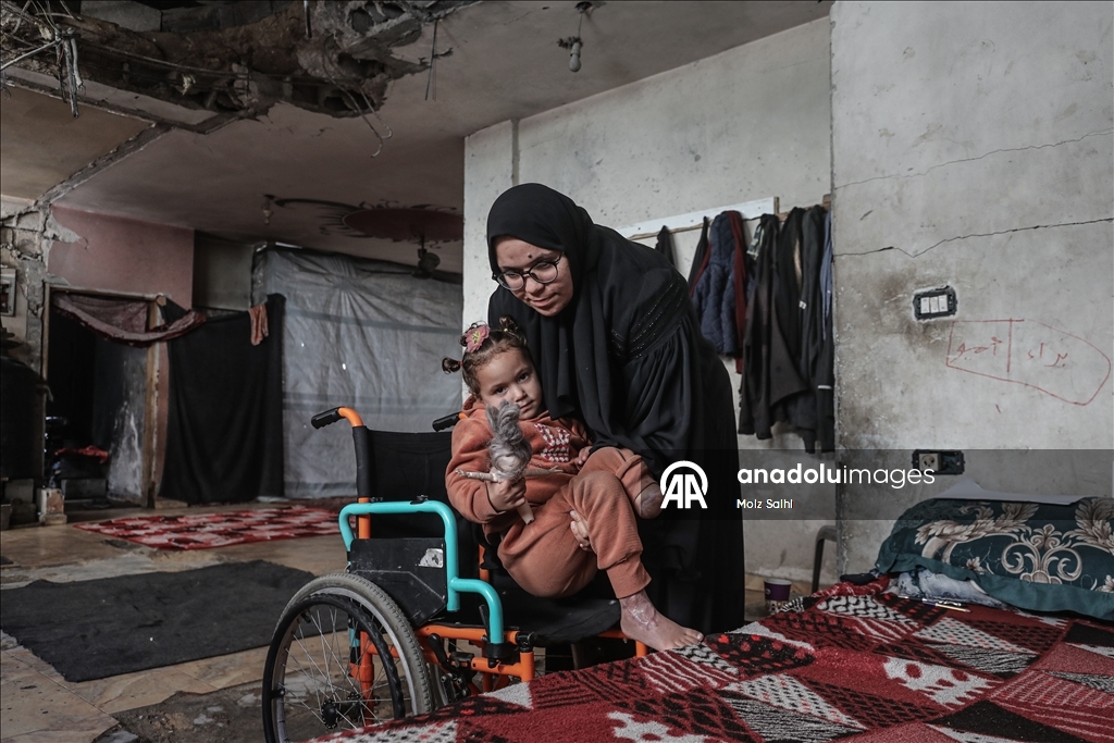 Надежда на протез для 4-летней Раван из Газы