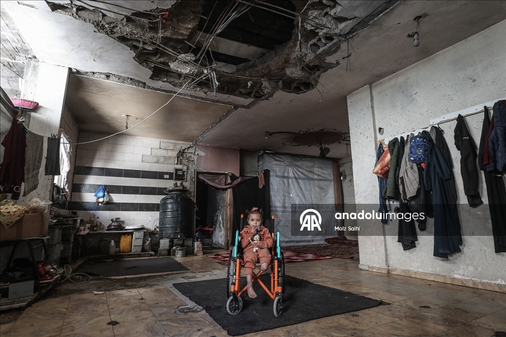 Надежда на протез для 4-летней Раван из Газы