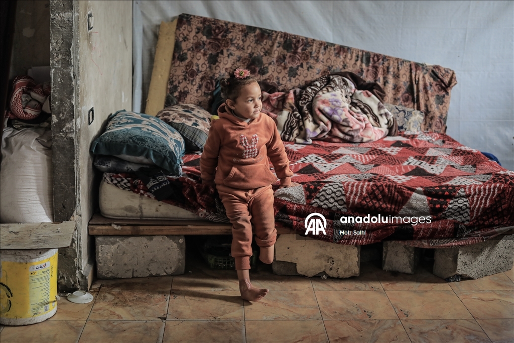 Надежда на протез для 4-летней Раван из Газы