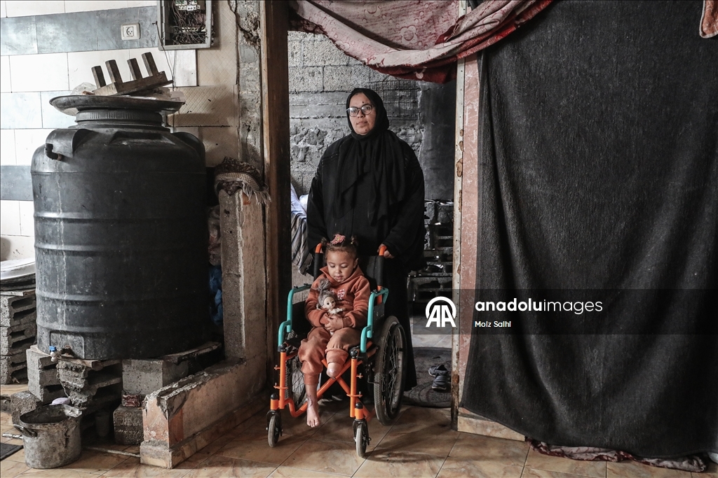 Надежда на протез для 4-летней Раван из Газы