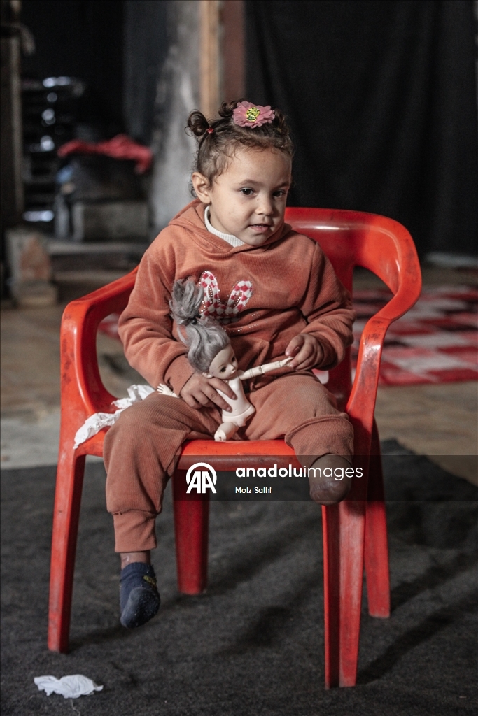 Надежда на протез для 4-летней Раван из Газы