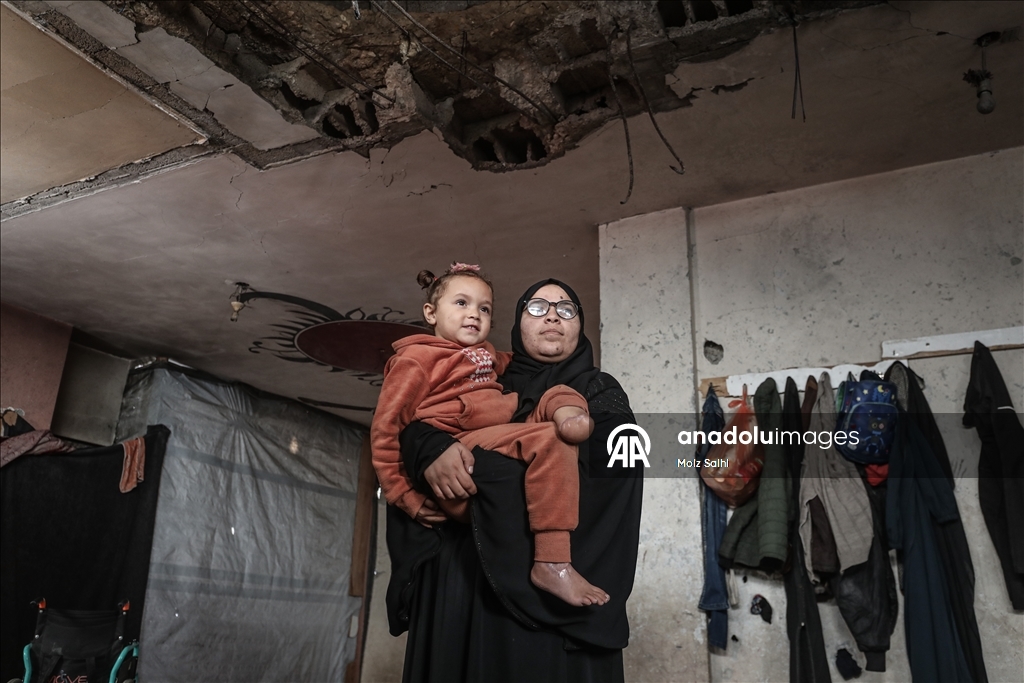 Надежда на протез для 4-летней Раван из Газы