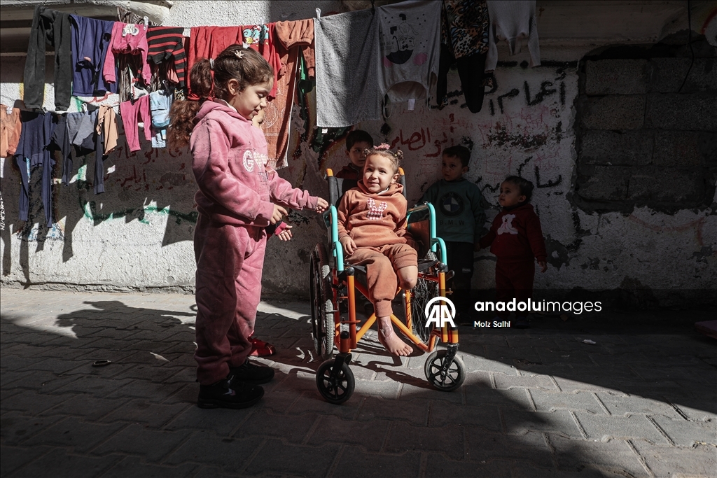 Надежда на протез для 4-летней Раван из Газы