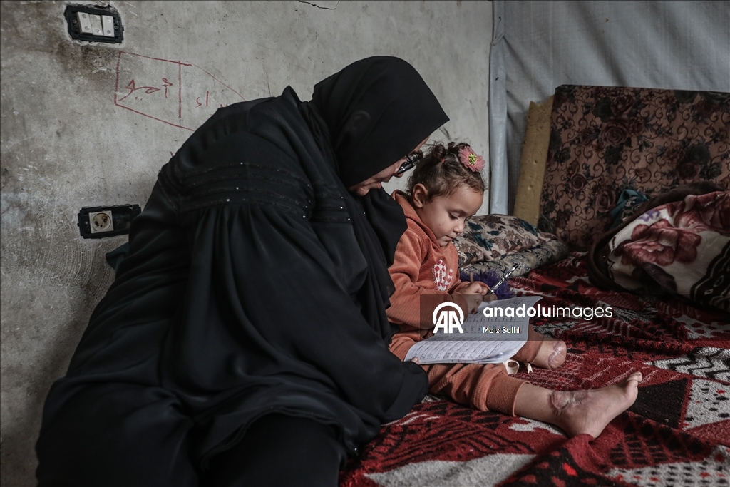 Надежда на протез для 4-летней Раван из Газы