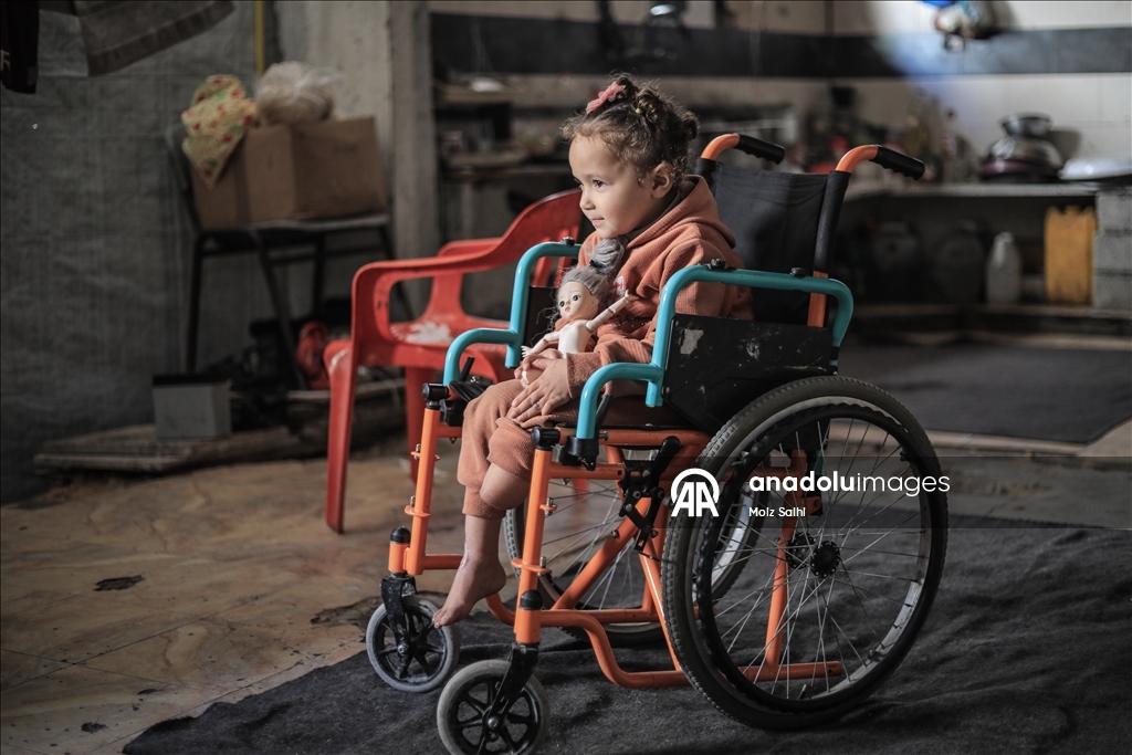 Надежда на протез для 4-летней Раван из Газы