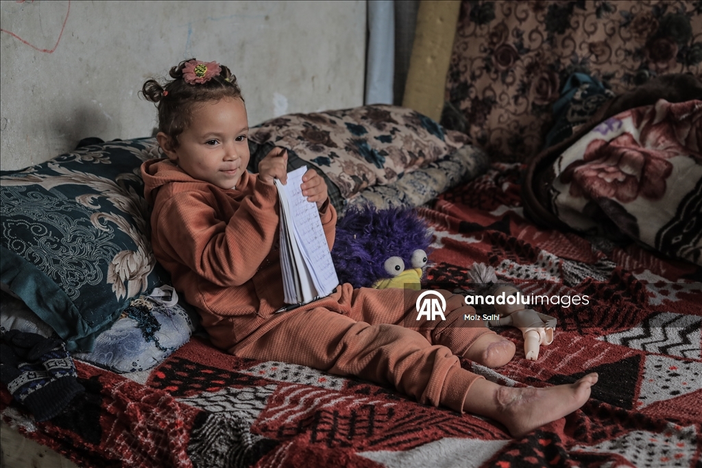 Надежда на протез для 4-летней Раван из Газы