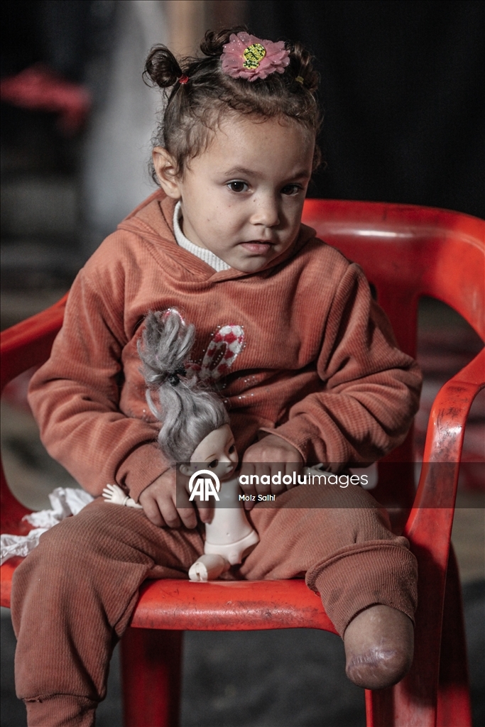 Надежда на протез для 4-летней Раван из Газы