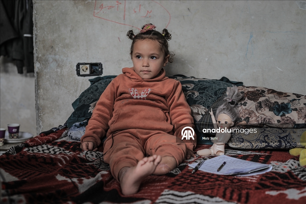 Надежда на протез для 4-летней Раван из Газы