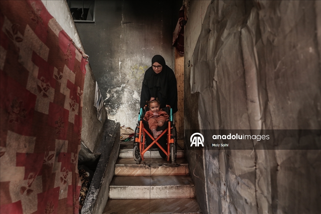 Надежда на протез для 4-летней Раван из Газы