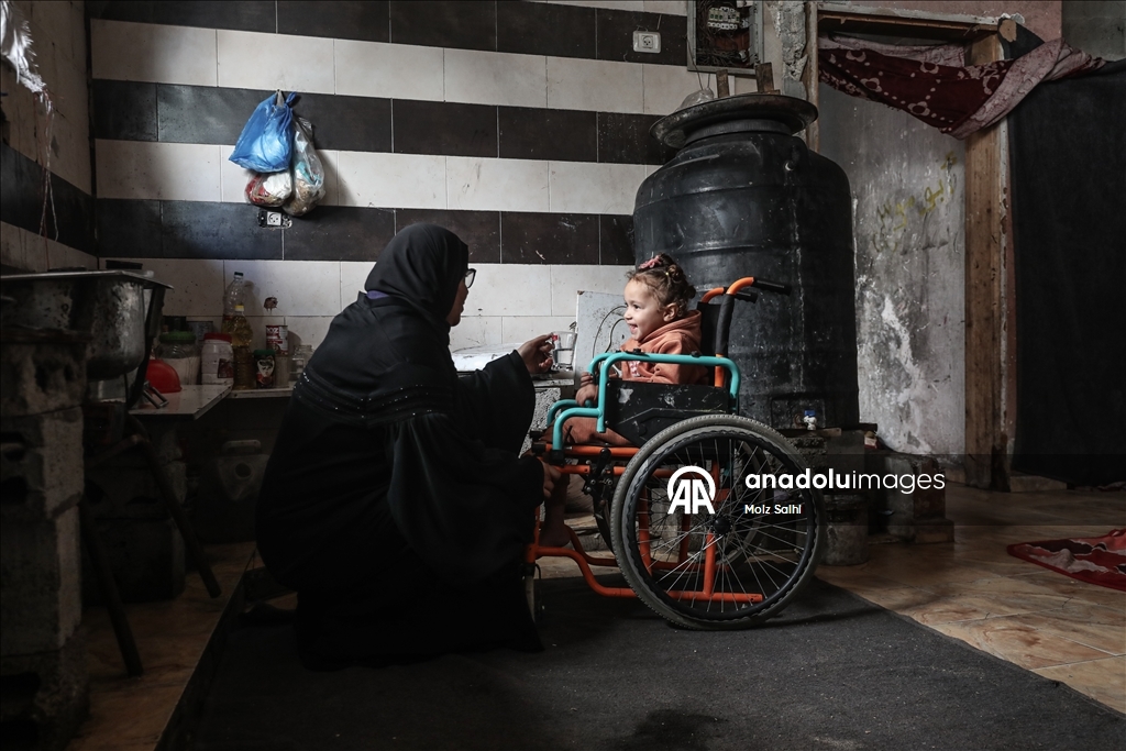 Надежда на протез для 4-летней Раван из Газы