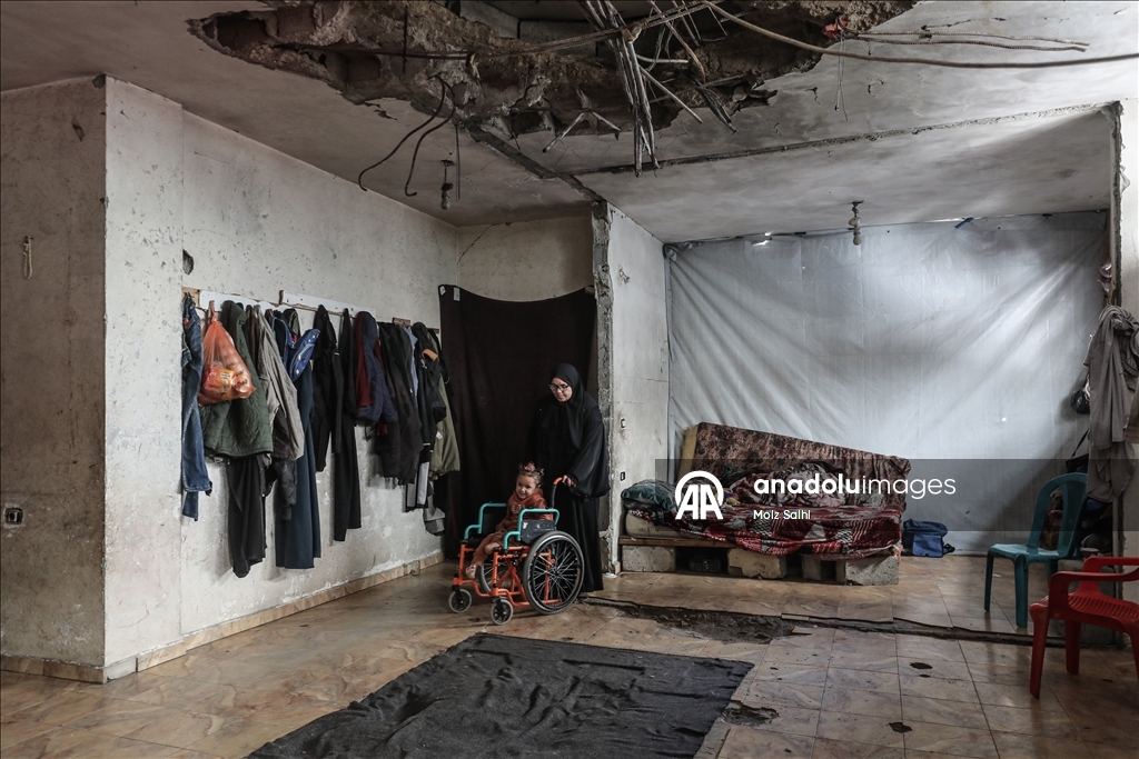 Надежда на протез для 4-летней Раван из Газы