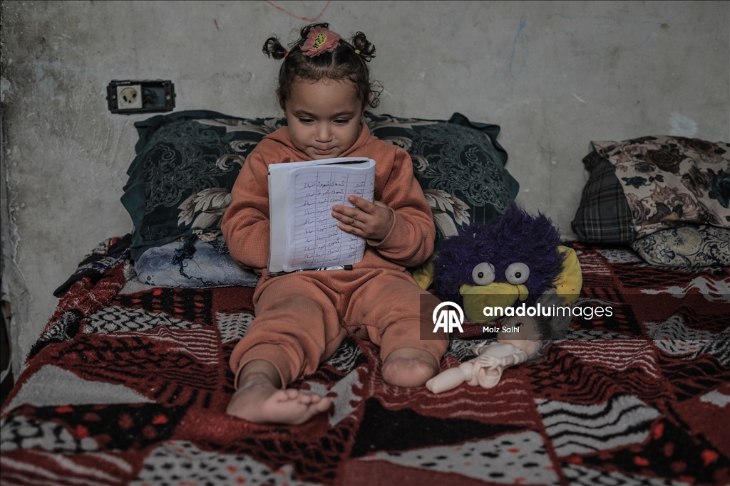 Надежда на протез для 4-летней Раван из Газы