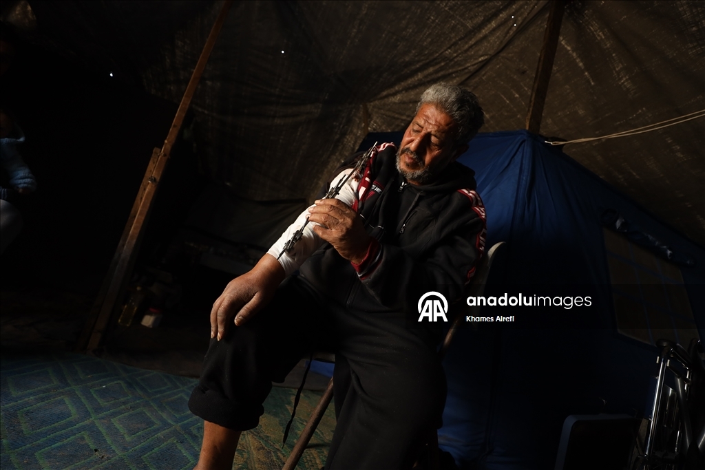 İsrail saldırısında yaralanan Filistinli Zuhayr, zor şartlar altında hayatını sürdürüyor