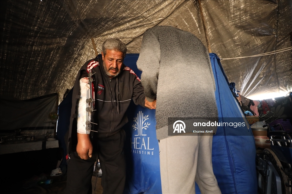 İsrail saldırısında yaralanan Filistinli Zuhayr, zor şartlar altında hayatını sürdürüyor