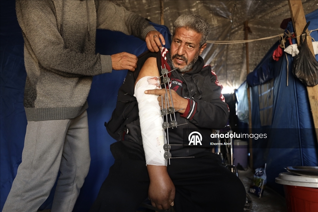 İsrail saldırısında yaralanan Filistinli Zuhayr, zor şartlar altında hayatını sürdürüyor