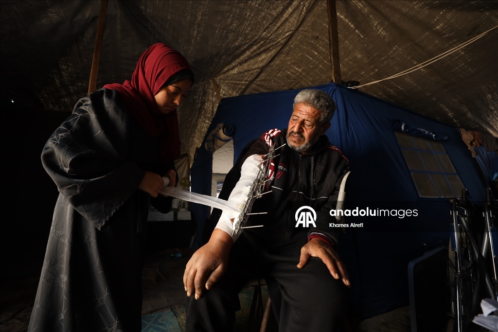 İsrail saldırısında yaralanan Filistinli Zuhayr, zor şartlar altında hayatını sürdürüyor