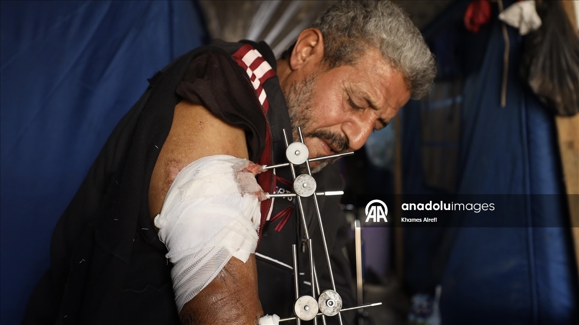 İsrail saldırısında yaralanan Filistinli Zuhayr, zor şartlar altında hayatını sürdürüyor