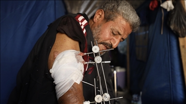 İsrail saldırısında yaralanan Filistinli Zuhayr, zor şartlar altında hayatını sürdürüyor