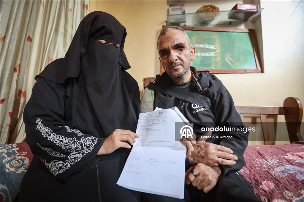 İsrail saldırısında görme yetisini kaybeden Ahmed Hırzullah, yaşam mücadelesi veriyor