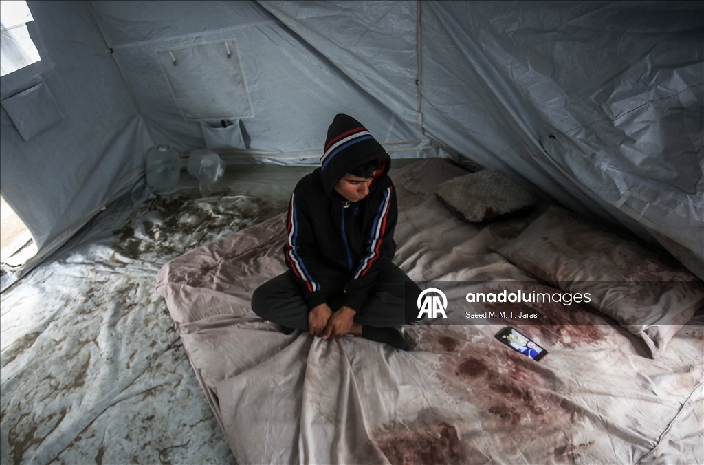 غزة.. صدمة تحاصر فلسطينيا فقد زوجته بعد يومين من الزفاف