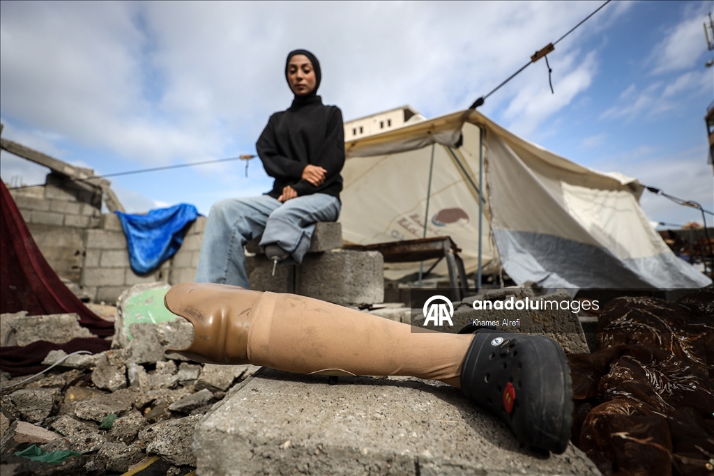 İsrail saldırısı sonucu bir bacağını kaybeden Filistinli sporcu, atletizme dönmeyi umut ediyor