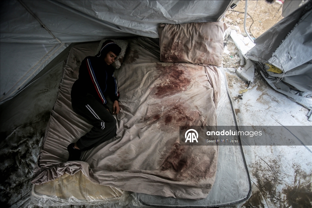 غزة.. صدمة تحاصر فلسطينيا فقد زوجته بعد يومين من الزفاف