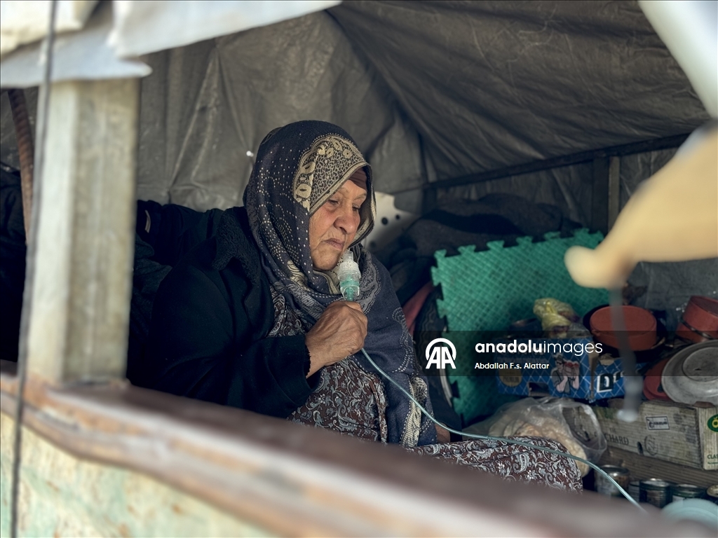 حين يعز العلاج.. مضخة الإطارات تعوض مولّد الأكسجين في غزة