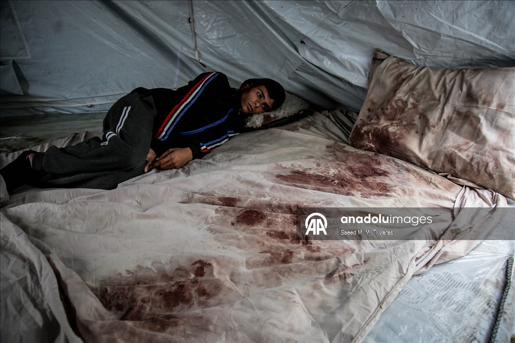 غزة.. صدمة تحاصر فلسطينيا فقد زوجته بعد يومين من الزفاف