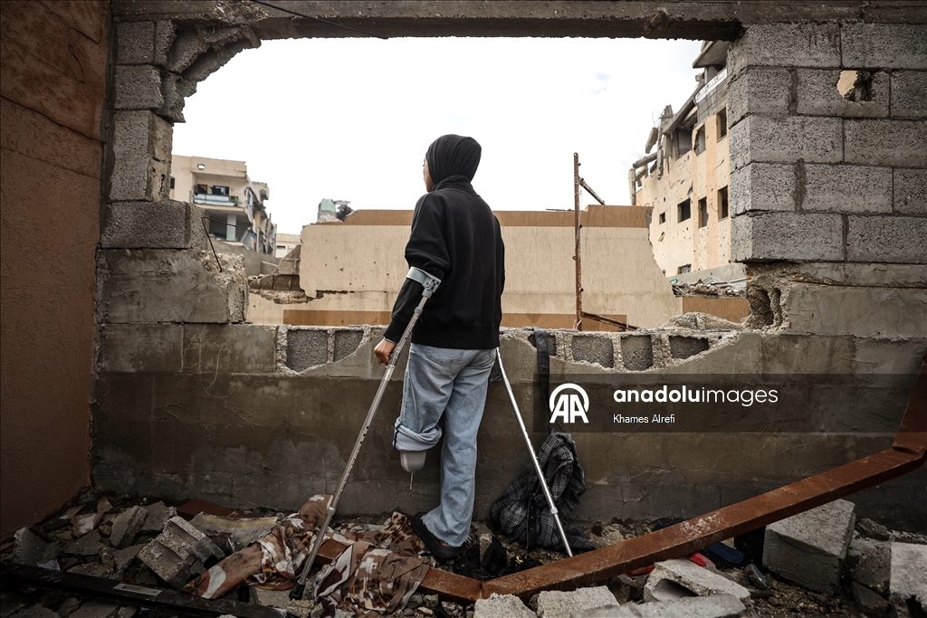 İsrail saldırısı sonucu bir bacağını kaybeden Filistinli sporcu, atletizme dönmeyi umut ediyor