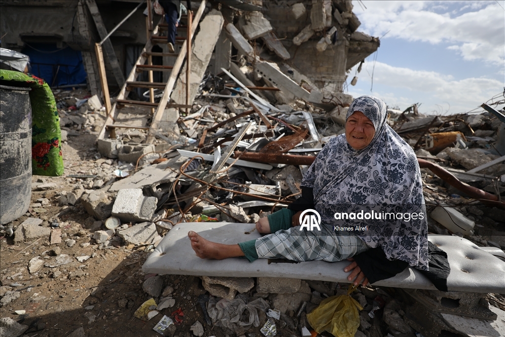 Лишившаяся ноги из-за израильских ударов палестинка нуждается в лечении за рубежом