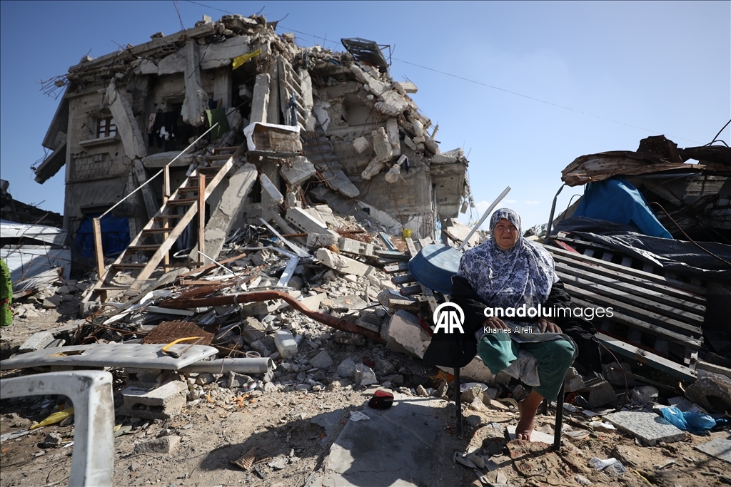 Лишившаяся ноги из-за израильских ударов палестинка нуждается в лечении за рубежом